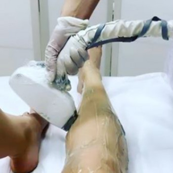 Лазерная эпиляция ноги до колена для мужчин