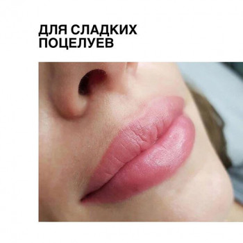 Лазерная эпиляция усов (верхней губы) для мужчин